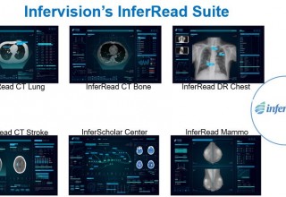 Infervision's Suite