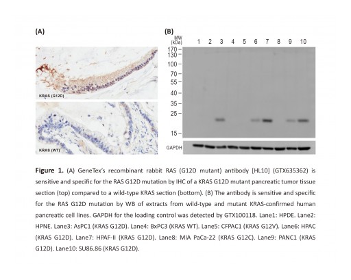 GeneTex Launches Novel Recombinant RAS (G12D Mutant) Antibody [HL10]