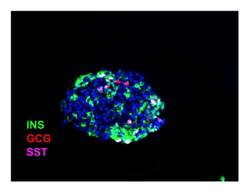 Seraxis Presents Successful Results Using Synthetic Replacement Endocrine Clusters for Type 1 Diabetes at the 4th IPITA / HSCI / JDRF Summit