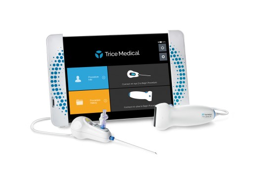 Trice Medical Launches the World's First Dynamic Imaging Platform, Adding Ultrasound Capability to the mi-eye®