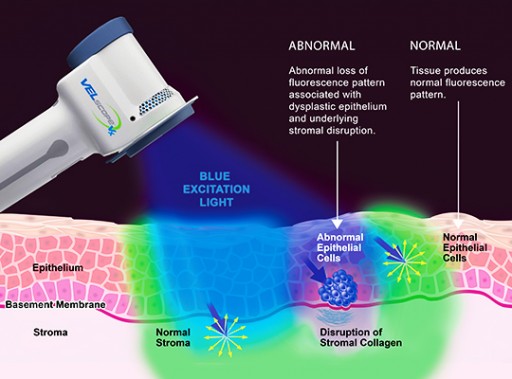 Apex Dental Offers Free Oral Cancer Screenings Across Utah Offices