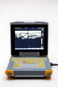 Ibex® EVO® Portable Ultrasound