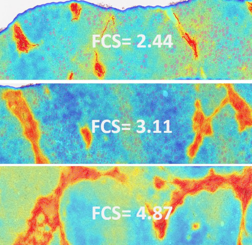 PharmaNest Presents NASH Digital Pathology and AI Results With a Performance That Compares to Histological Stages and Imaging Methods at the Liver Meeting® | AASLD 2022