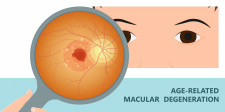 New Macular Degeneration Medication