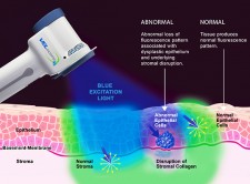 Velscope Fluorescence