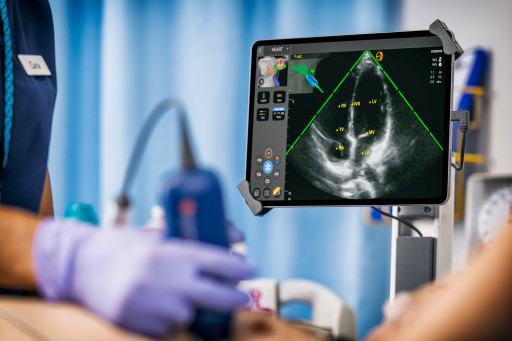 EchoNous Unveils Kosmos Plus: Giving Hospitals a Low-Cost Alternative to Expensive Ultrasound Carts Without Compromising on Image Quality or Advanced Capabilities