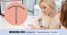 Mirena IUD Pseudotumor Cerebri