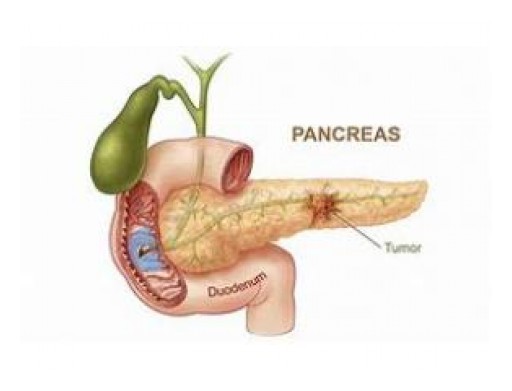 Pancreatic Fistula Treatment Market Development in 2019