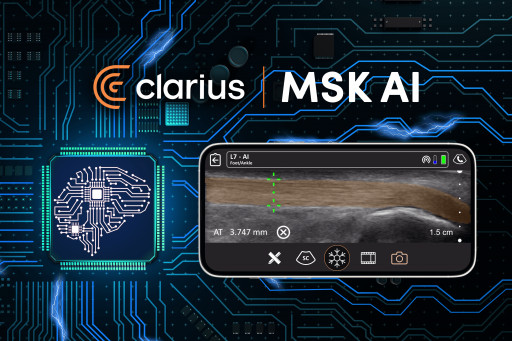 Clarius Announces the First FDA-Cleared AI Ultrasound Application for Musculoskeletal Imaging