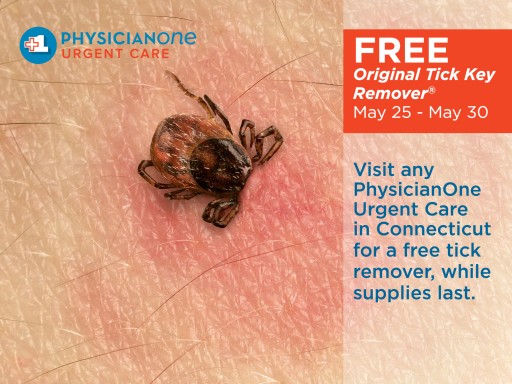 Free Tick Removers Available in Connecticut During Memorial Day Weekend