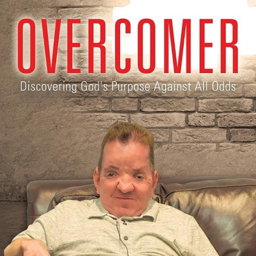 Christian Evangelist Releases New Book Depicting His Life With Apert Syndrome