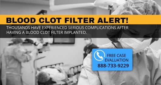 High Rates of IVC Filters May Malfunction, Become Difficult and Dangerous to Remove