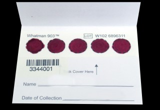 Dried blood spot card