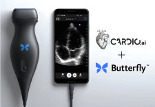 iCardio.ai + Butterfly Partnership