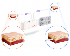 SOMAVAC Deep Tissue Negative Pressure Therapy