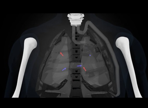 Artificial Lung Air Flow Device