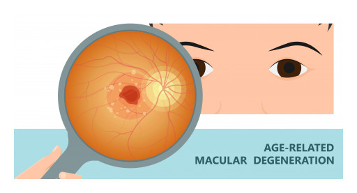 Mid Atlantic Retina Physicians Part of Clinical Trial Team for Groundbreaking New Macular Degeneration Medication