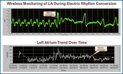 ISS' Wireless Left-Heart Implantable Hemodynamic Monitoring System for Patients With Congestive Heart Failure: Exhibition at HFSA 19th Annual Scientific Meeting