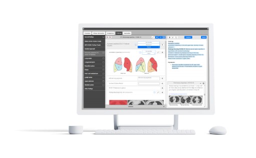 Smart Reporting Provides Free Template to Support Radiologists in Suspected COVID-19 Cases