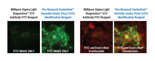 Inventor of Shingrix™ Develops New Chickenpox and Shingles Virus Detection Test