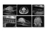 Magnus MRI Images