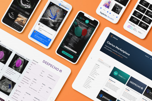 Clarius Marketplace Unlocks the Power of AI Innovation for Ultrasound Imaging