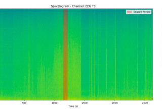 Spectrogram Visualization