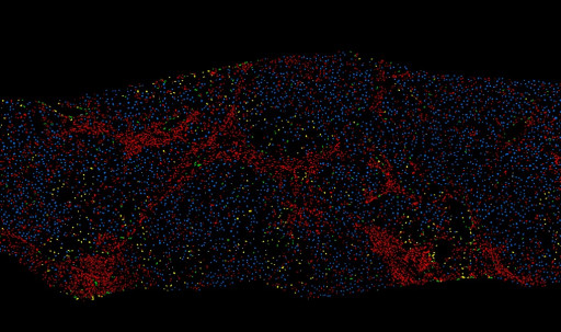 PharmaNest Launches Its Digital Pathology Spatially Resolved, Quantitative Tissue Panels to Quantify Tissue Injury and Inflammation in the Context of Fibrotic Conditions