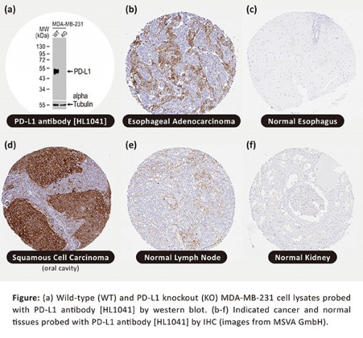 GeneTex Launches PD-L1 Antibody Comprehensively Validated by MS Validated Antibodies GmbH for Immunohistochemistry