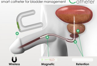 Connected Catheter 2P