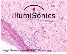 Pars Pathology image