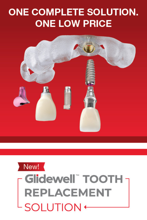 Glidewell Launches Glidewell(TM) Tooth Replacement Solution for Implant Treatment