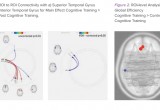 LearningRx brain image