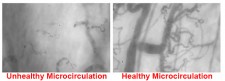 Healthy vs Unhealthy Microcirculation