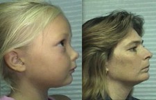 A similar appearance, but mom wants better for her little girl.