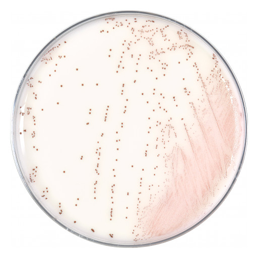 Introducing HardyCHROM™ Group a Strep Agar