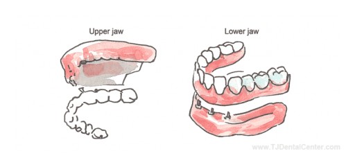 Dr. Esteban Ramirez Introduces TJ Dental Center's Website for Discount Dental Work in Tijuana, Mexico