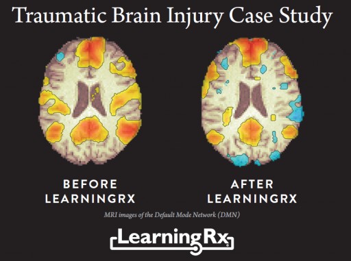 LearningRx Brain Training Celebrates 15 Year of Franchising  With Lower Franchise Fees and Initial Investment