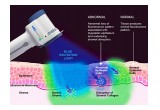 Velscope Fluorescence